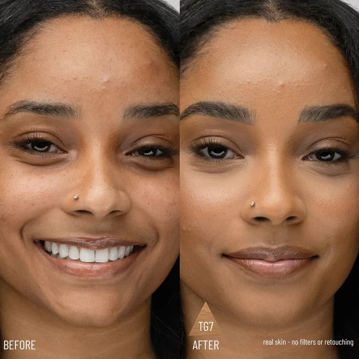 Confident Complexion Duo