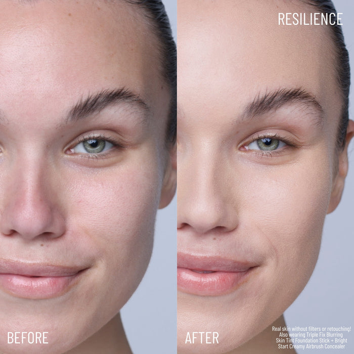 Resilience